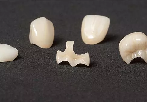 Different types of dental restorations shown on black background.